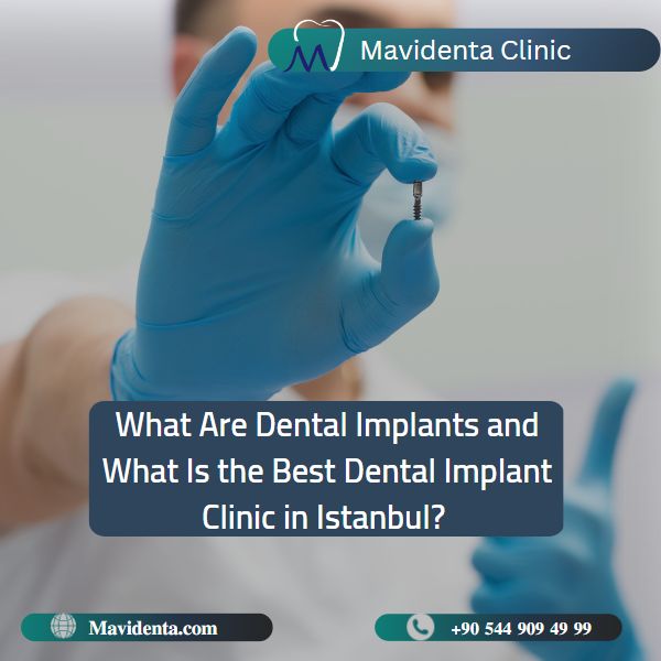 Best Dental Implant Clinic in Istanbul Best Dental Implant Clinic in Istanbul