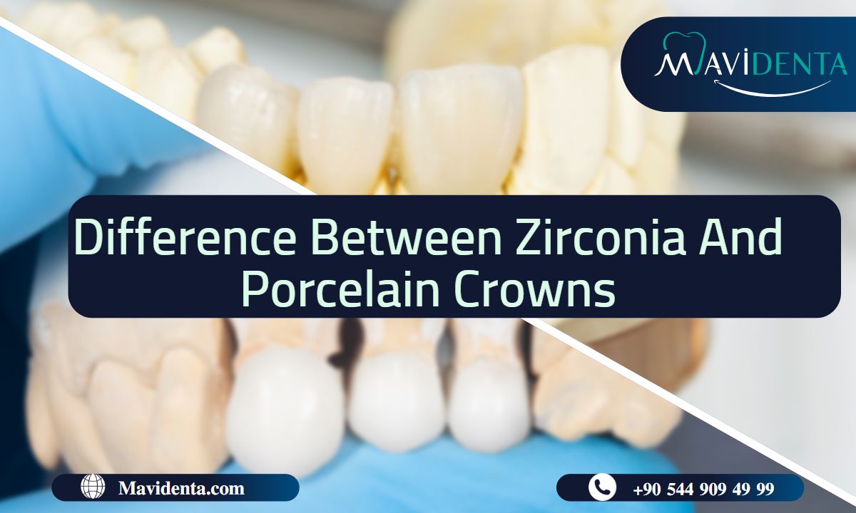 Difference Between Zirconia And Porcelain Crowns