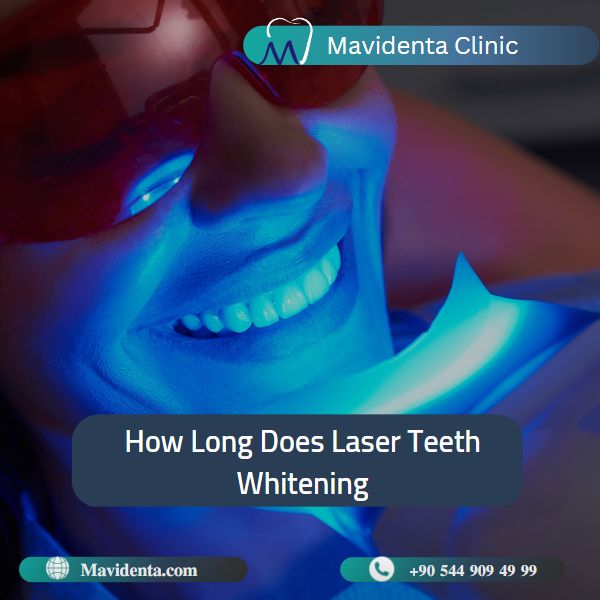 laser teeth whitening Turkey cost laser teeth whitening Turkey cost