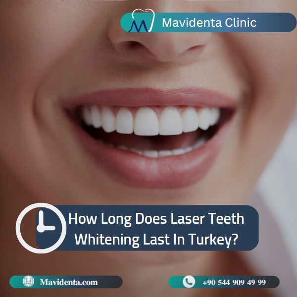 laser teeth whitening Turkey cost laser teeth whitening Turkey cost