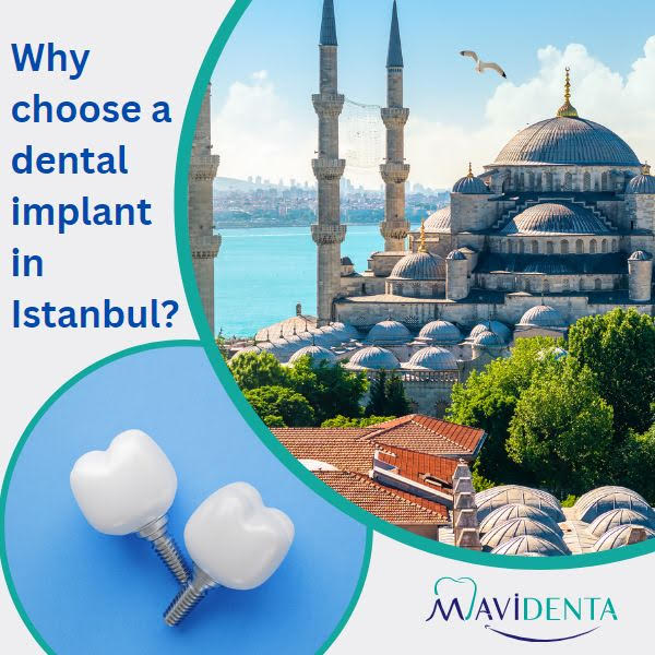 How Much Does a Full Set Of Dental Implants Cost In Turkey