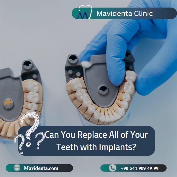 How Much Does it Cost to Replace a Tooth How Much Does it Cost to Replace a Tooth