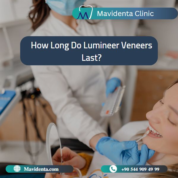 Lumineers Veneers Turkey