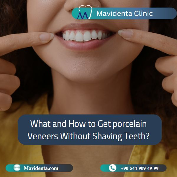 Porcelain Veneers Without Shaving Teeth Porcelain Veneers Without Shaving Teeth
