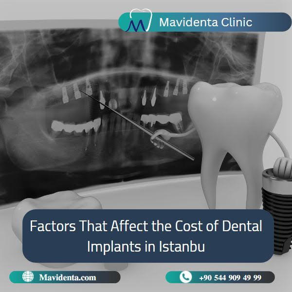 Cheapest Place To Get Full Mouth Dental Implants Cheapest Place To Get Full Mouth Dental Implants