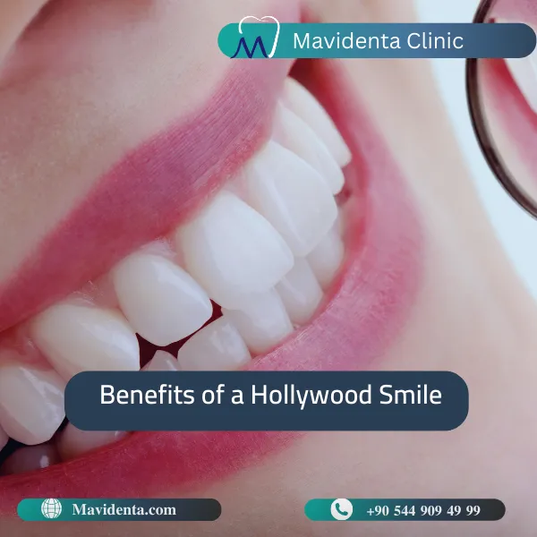 Hollywood Smile Price Turkey Hollywood Smile Price Turkey