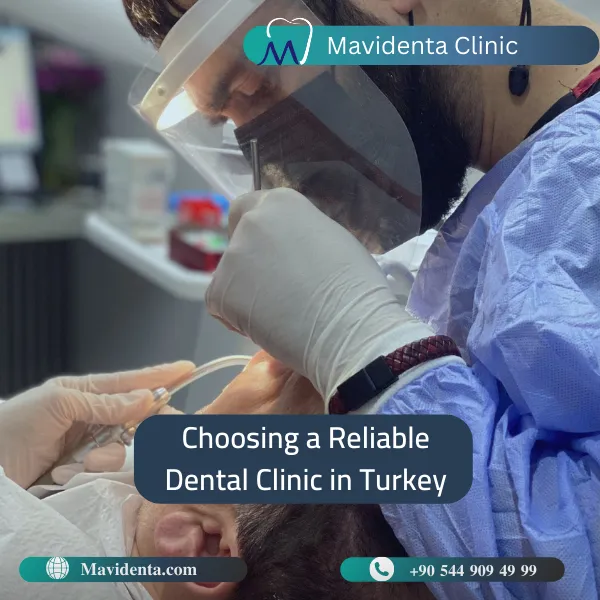 Hollywood Smile Price Turkey Hollywood Smile Price Turkey