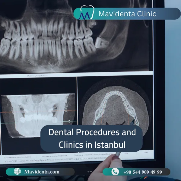 Dental Tourism in Istanbul Turkey 