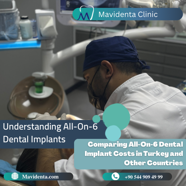 All On 6 Dental Implants Cost In Turkey All On 6 Dental Implants Cost In Turkey
