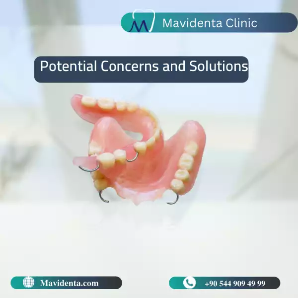 Partial Dentures for Front Teeth Partial Dentures for Front Teeth