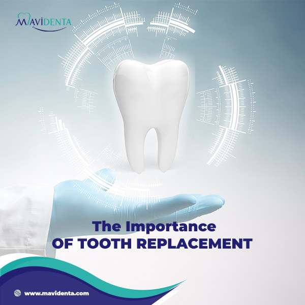 dental implant 10 years after extraction