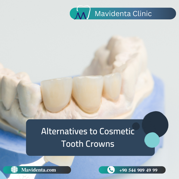 Cosmetic Tooth Crown