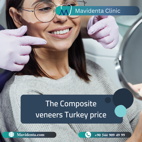 Composite Veneers Turkey Price Effective Solution for Your Perfect Smile 