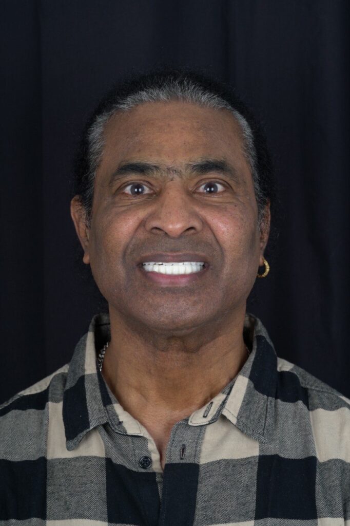 All on 4 Dental Implants All on 4 Dental Implants