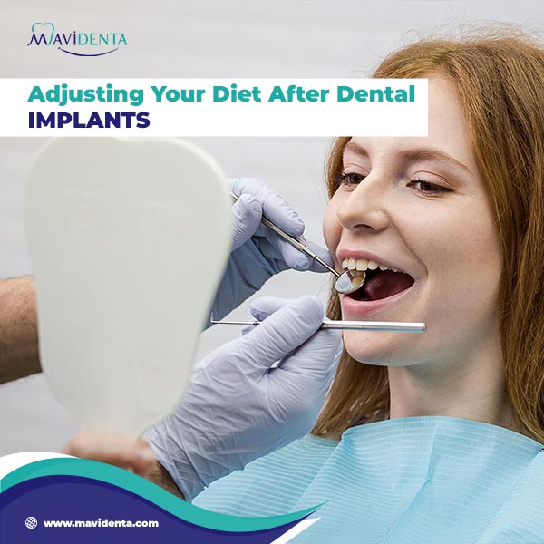 How Long After Dental Implants Can I Eat Normally How Long After Dental Implants Can I Eat Normally