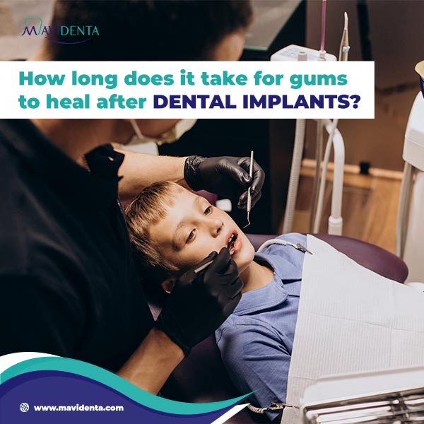 How To Heal Faster After Dental Implants