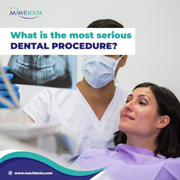 list of dental procedures and prices