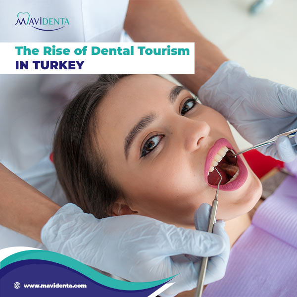 is it worth going to turkey for dental implants is it worth going to turkey for dental implants