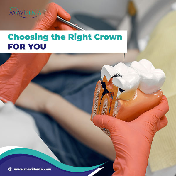 Ceramic vs Porcelain Crown which is better Ceramic vs Porcelain Crown which is better