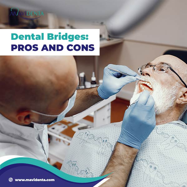pros and cons of dental implants vs bridges