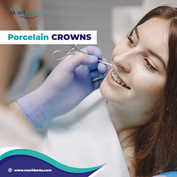 Ceramic vs Porcelain Crown which is better Ceramic vs Porcelain Crown which is better