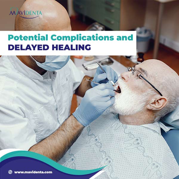 Implant Tooth Healing Time Implant Tooth Healing Time