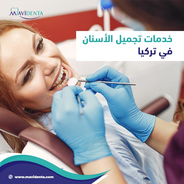 تجميل الأسنان في تركيا تجميل الأسنان في تركيا