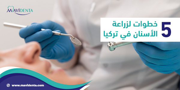 الرئيسية زراعة الأسنان فى تركيا