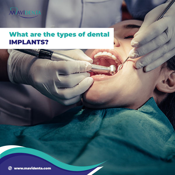 types of dental implants cost types of dental implants cost