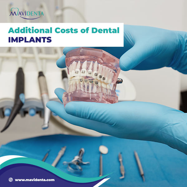 How Much Is Dental Implants? Additional Costs of Dental Implants