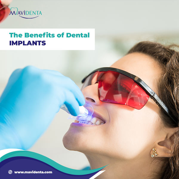 What is the Best Country for Dental Implants What is the Best Country for Dental Implants