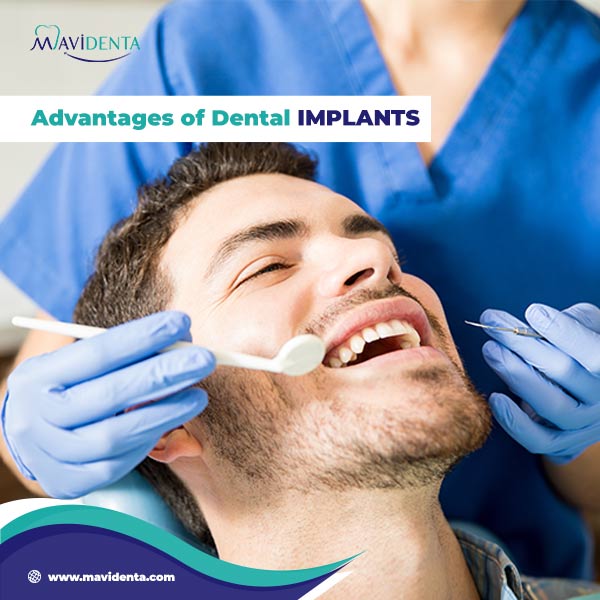 Dental implants full mouth cost Dental implants full mouth cost