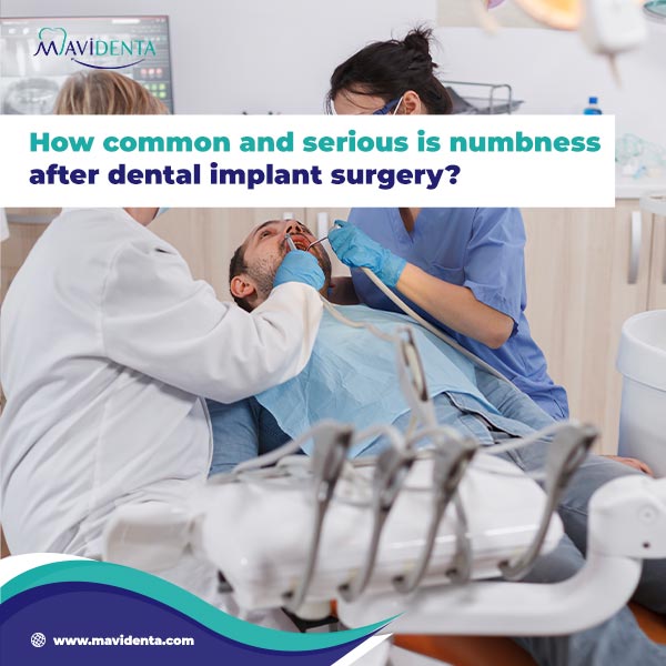 How Long Does Numbness Last After Dental Implant How Long Does Numbness Last After Dental Implant