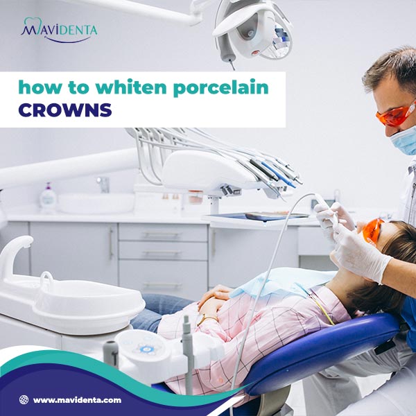 How To Whiten Porcelain Crowns How To Whiten Porcelain Crowns