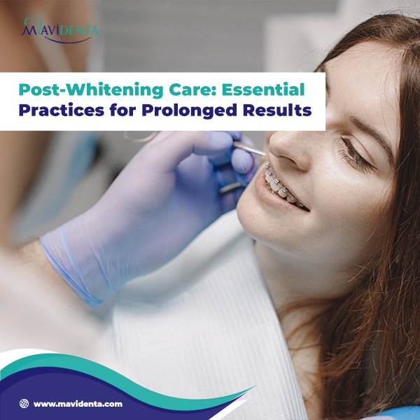 How Long Does Laser Teeth Whitening Last How Long Does Laser Teeth Whitening Last