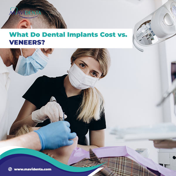 Dental Implants Vs Veneers Cost What Do Dental Implants vs. Veneers Cost