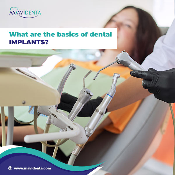 What Are The 3 Types of Dental Implants