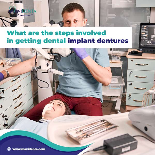 all on 4 vs all on 6 cost all on 4 vs all on 6 cost