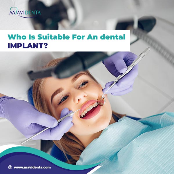 Most Affordable Dental Implants