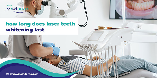 how long does laser teeth whitening last