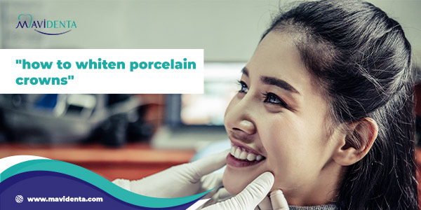 how to whiten porcelain crowns
