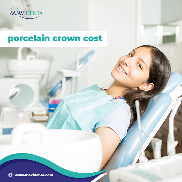 Are Porcelain Crowns Strong? Explained! Are Porcelain Crowns Strong
