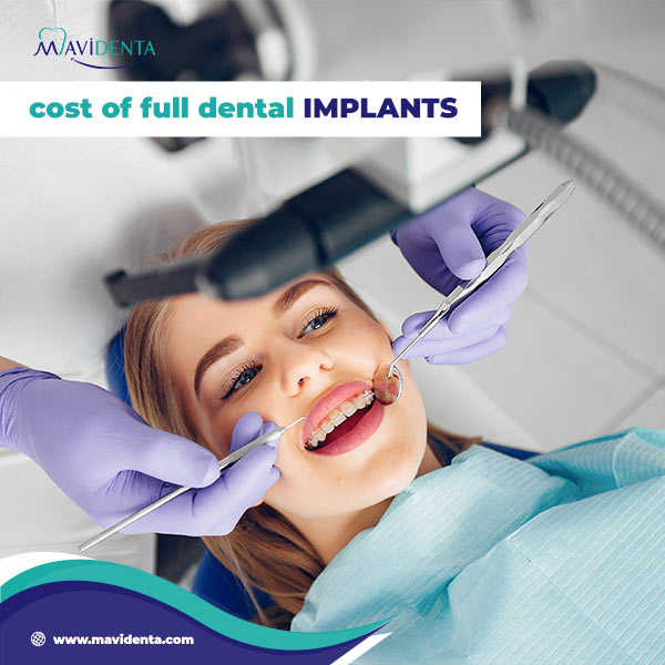 Dental Implants Cost Per Tooth Dental Implants Cost Per Tooth