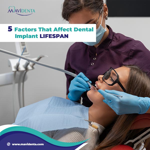 How long does dental implants last How long does dental implants last