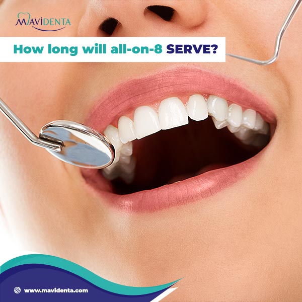 How long will all-on-8 serve