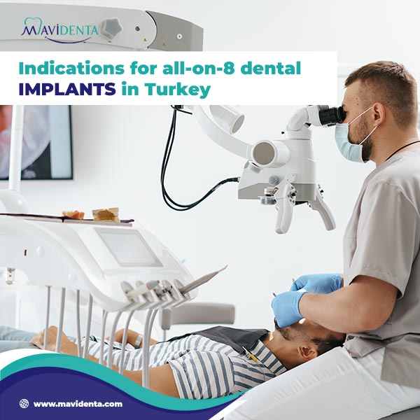 Indications for all-on-8 dental implants in Turkey