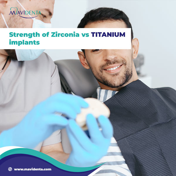 Dental Implants Zirconia Vs Titanium: Which is Right for You? Strength of Zirconia vs Titanium implants