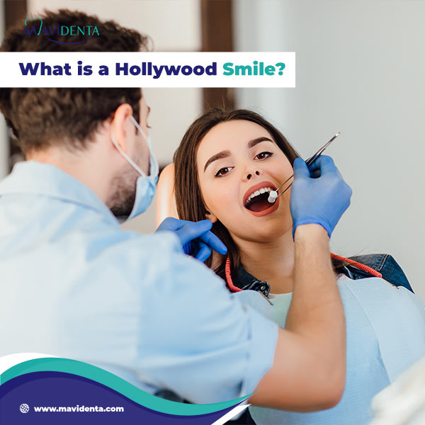 The Complete Guide to Hollywood Smile Dental Price Hollywood Smile Dental Price