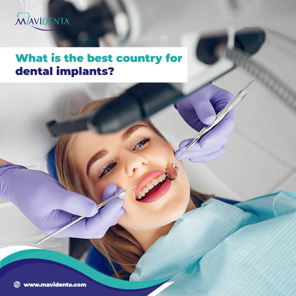 The Best Places That Do Dental Implants Places That Do Dental Implants