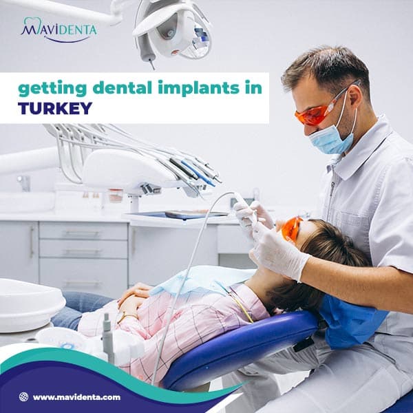 Best Rated Dental Implants: A Comprehensive Guide best rated dental implants